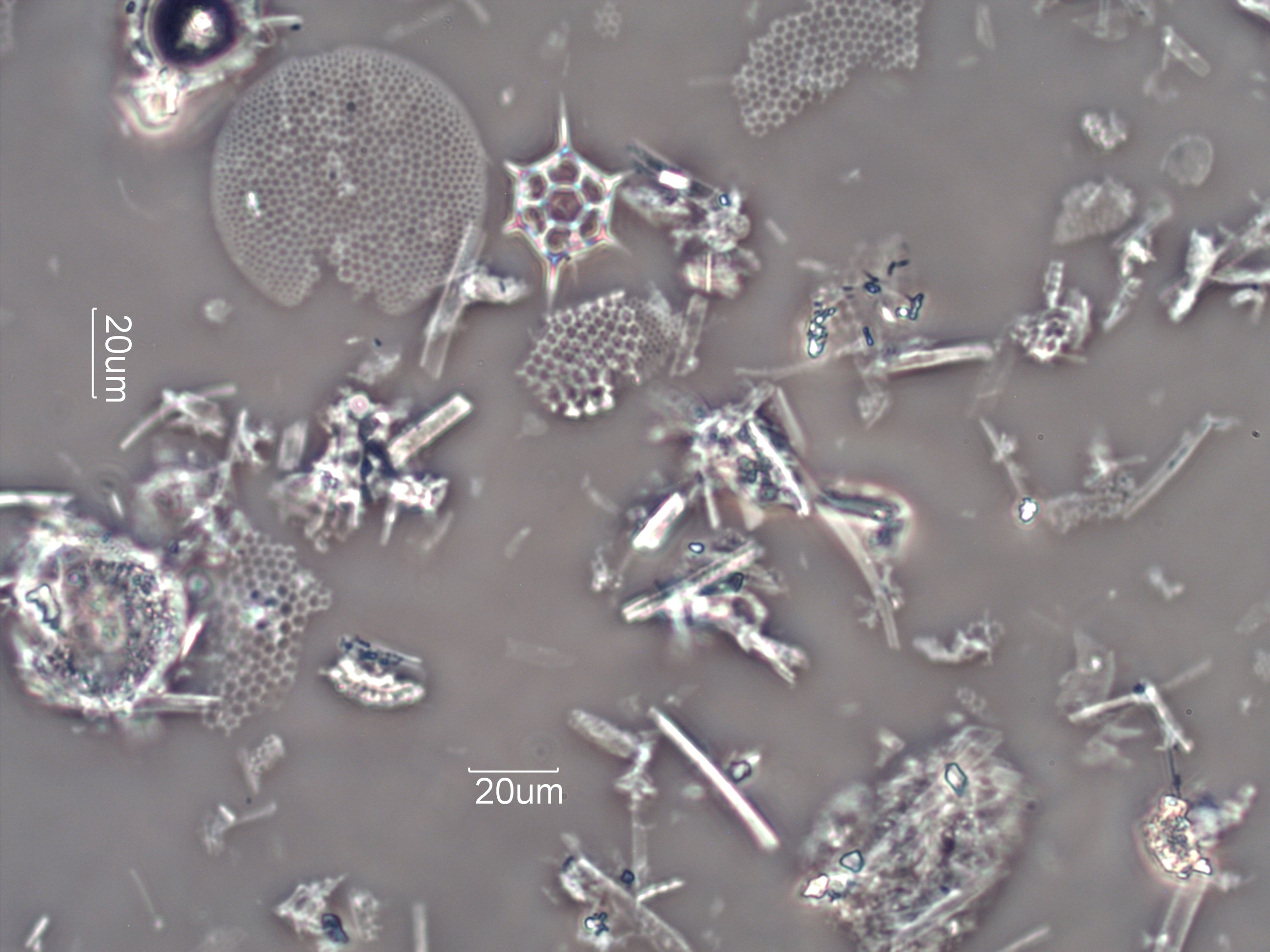 Diatomaceous Earth Under Microscope